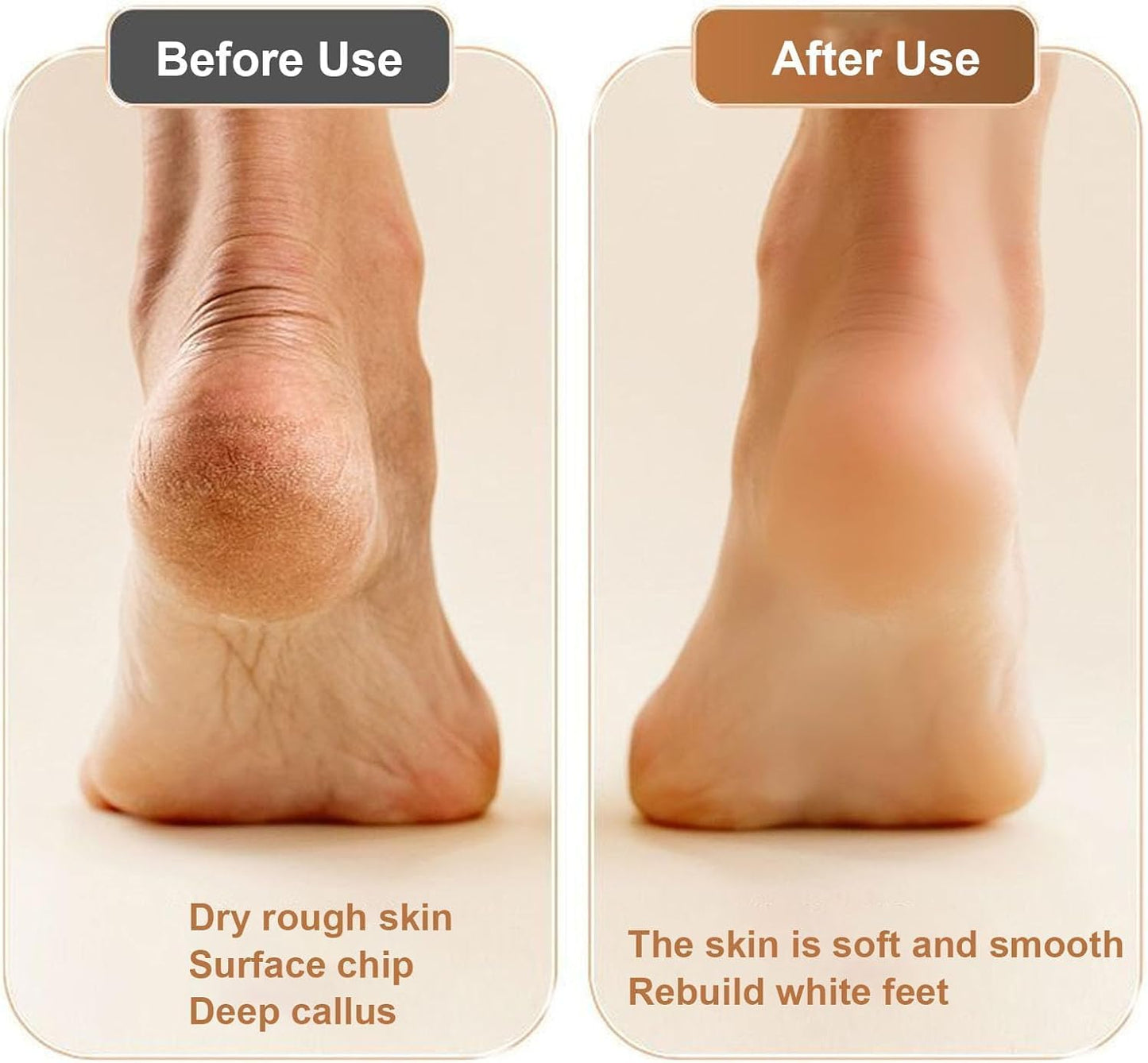 Say goodbye to rough feet! 🌟✨ Get smooth and soft soles with the Voalsz Electric Foot Callus Remover! Perfect for everyone, it features 3 replacement grinding heads and a stylish yellow design. Your feet deserve the best! 💛🦶 #FootCare #SelfCare